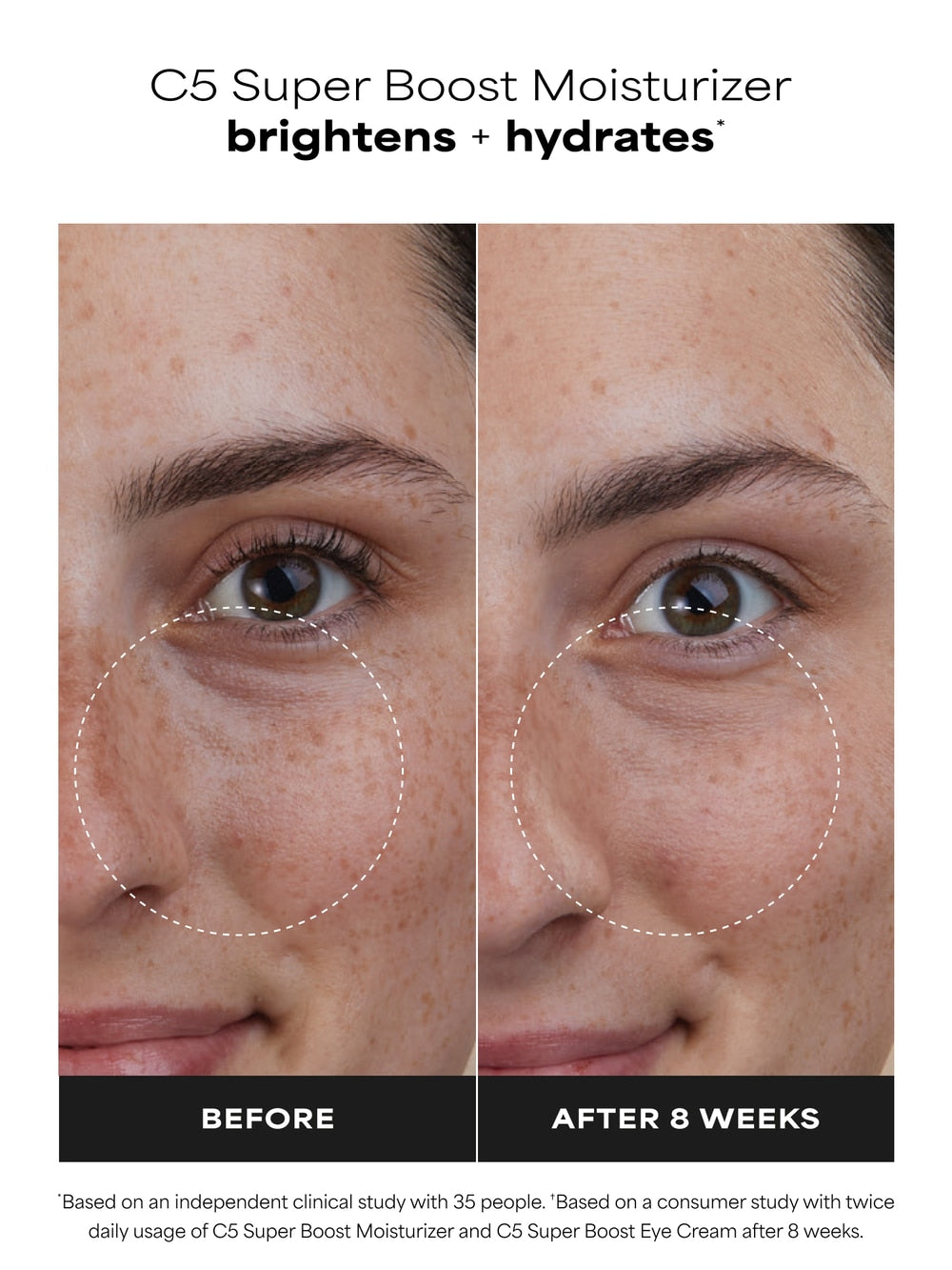 C5 Super Boost Moisturizer