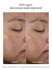 C15 Brightening Super Booster